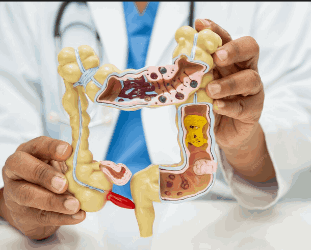 Appendix क्या है