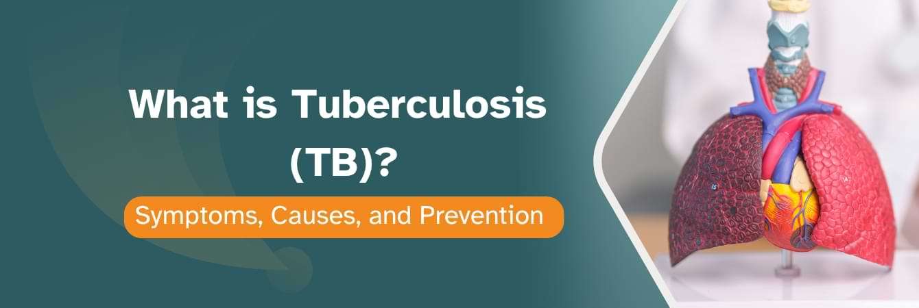 What is Tuberculosis (TB) Symptoms, Causes, and Prevention